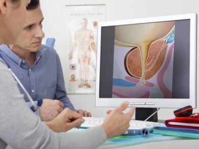 Un urologue consulte un patient au sujet de la prostatite et des méthodes de traitement.